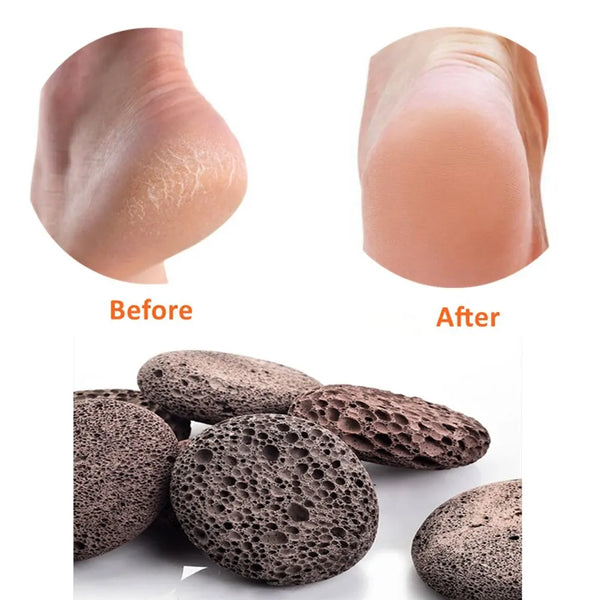 Scrubber Stone Pedicure Tools.